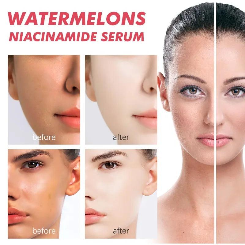 Watermelon Glow Niacinamide Dew Drops: Brightening Serum & Makeup Primer.