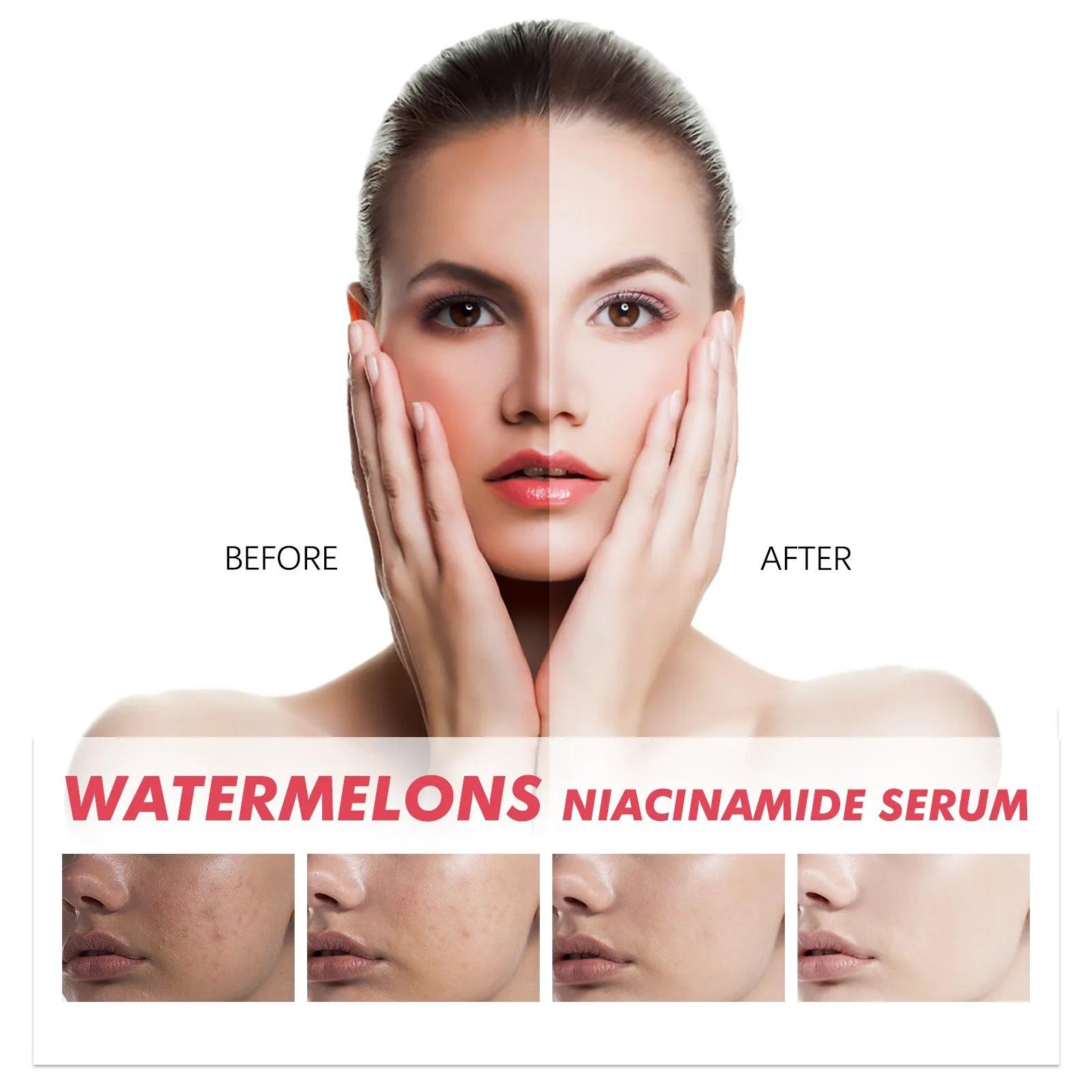 Watermelon Glow Niacinamide Dew Drops: Brightening Serum & Makeup Primer.