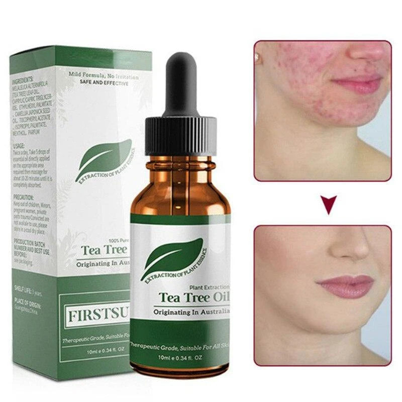 Tea tree oil: Face, body, hair care, fragrance, massage essential.