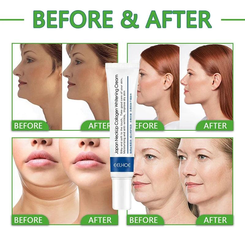 Neck Firming Cream: Anti-aging, Tightens, Whitens, Moisturizes. Reduces Double Chin.